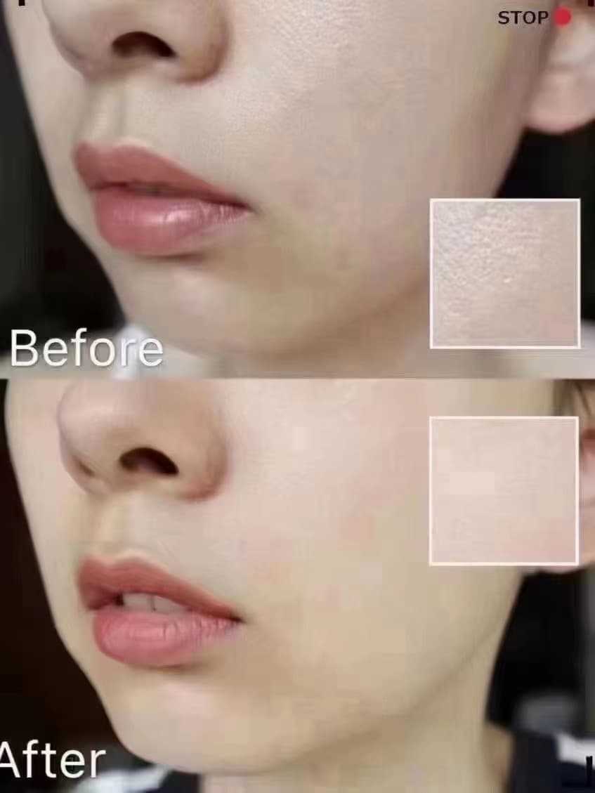 Skin Texture Refinement